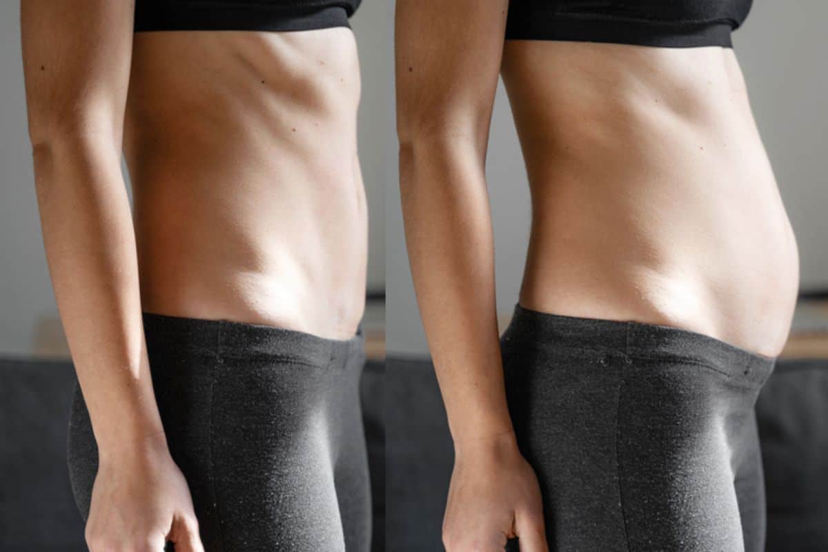 How long does diastasis recti take to improve Sparkhill?