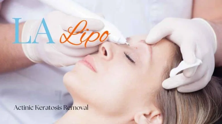 Woman receiving Actinic Keratosis Removal Treatment Sparkhill