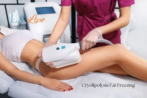 Woman receiving coolsculpting Sparkhill treatment on her thighs