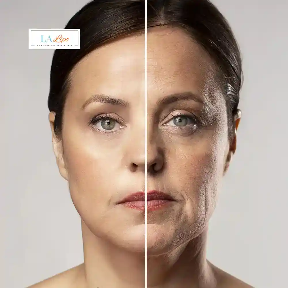 How Can You Tell If Non-Surgical Skin Tightening Is Right for You Sparkhill?