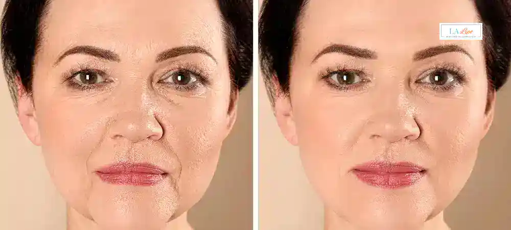Why Aren’t My Skincare Products Making My Sagging Skin Look Firmer Sparkhill?