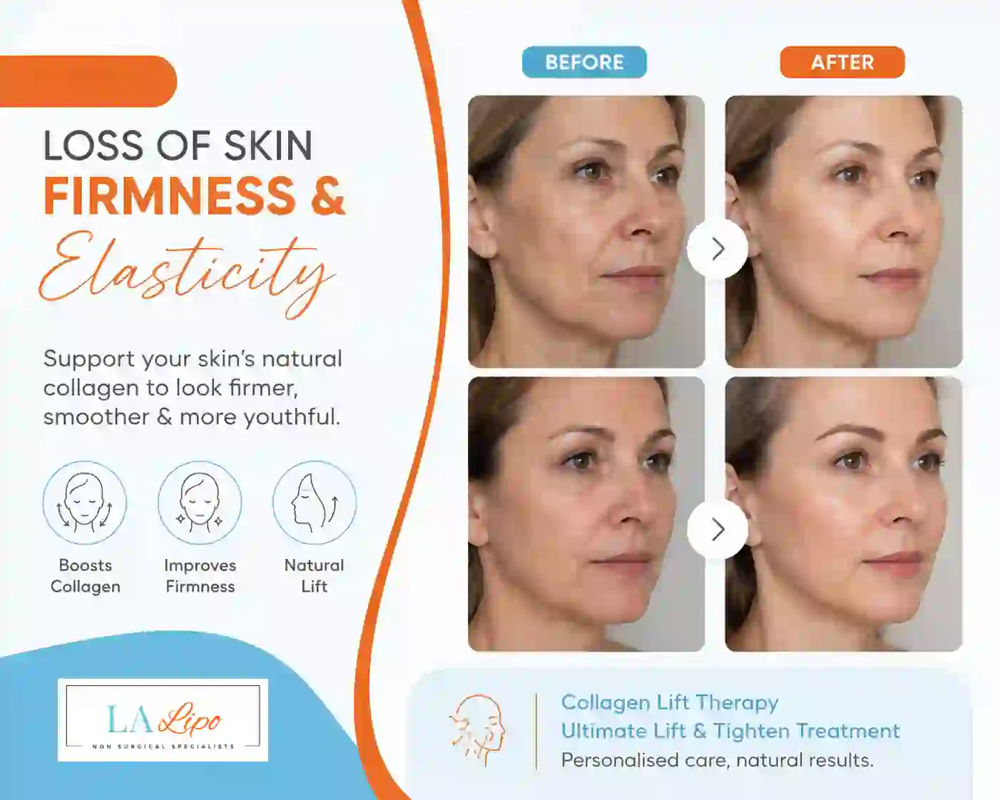 Sign #7: Loss of Skin Firmness and Elasticity Sparkhill