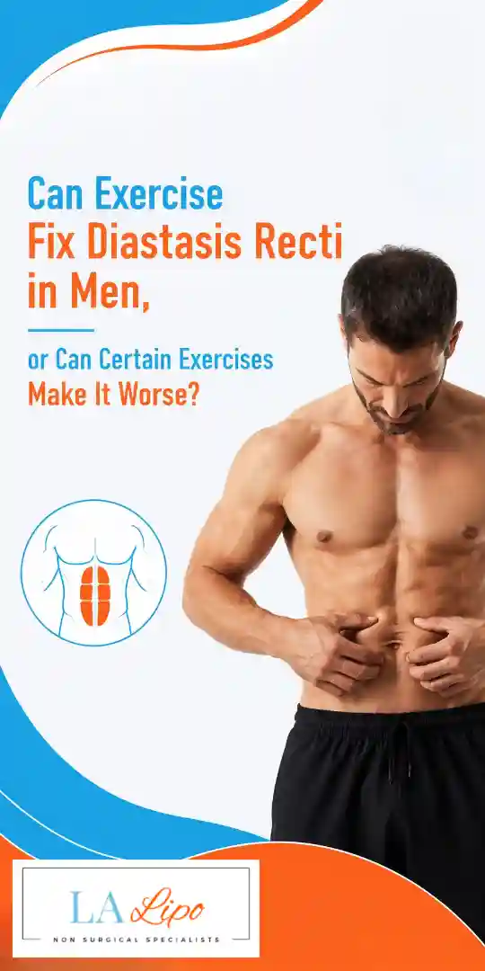 Can Exercise Fix Diastasis Recti in Men, or Can Certain Exercises Make It Worse Sparkhill?